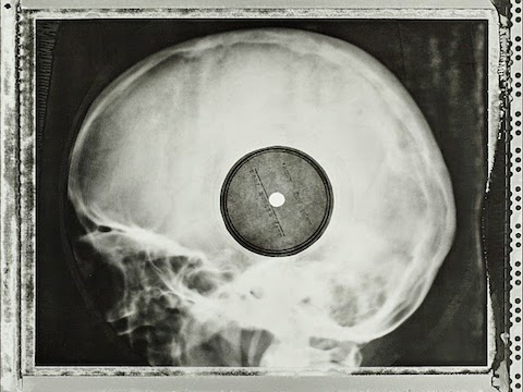When Soviet Youth Bootlegged Western Rock Music on Discarded X-Rays: Hear Original Audio Samples When Soviet Youth Bootlegged Western Rock Music on Discarded X-Rays: Hear Original Audio Samples